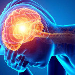 DERRAME CEREBRAL – Como saberlo y tratamiento > Healthy Food Tips > Tips para tu salud