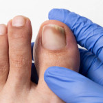 Como curar el HONGO en las uñas > Healthy Food Tips > Tips para tu salud