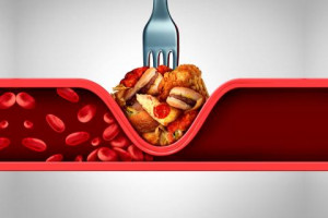 Como reducir los TRIGLICERIDOS > Healthy Food Tips > Tips para tu salud